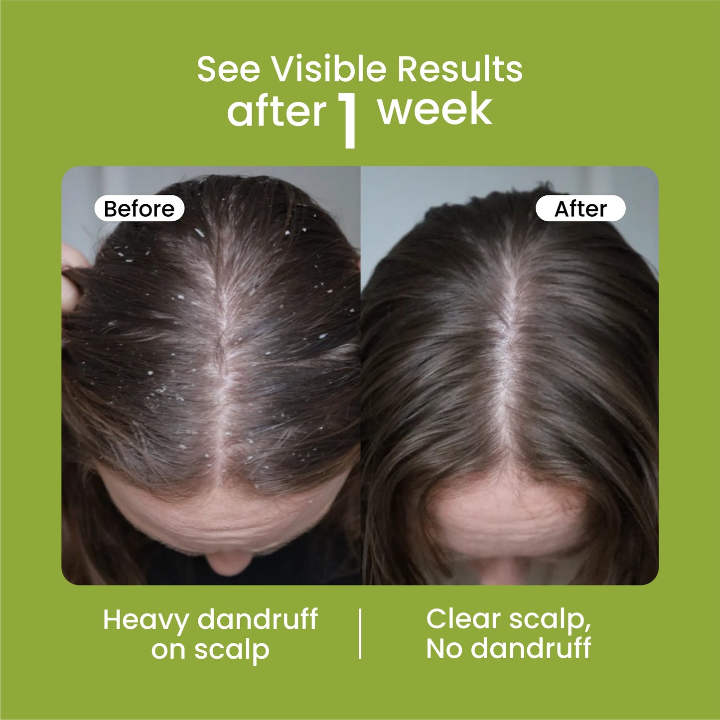 Mielle Natural Rosemary Essential Oil For Hair Growth & Strengthening Oil 59 ML