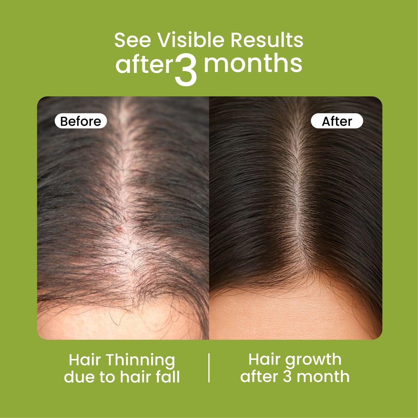 Mielle Natural Rosemary Essential Oil For Hair Growth & Strengthening Oil 59 ML