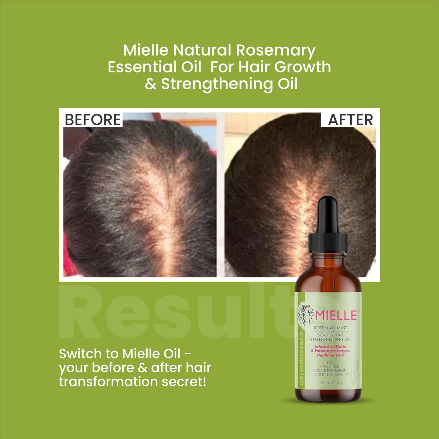 Mielle Natural Rosemary Essential Oil For Hair Growth & Strengthening Oil 59 ML