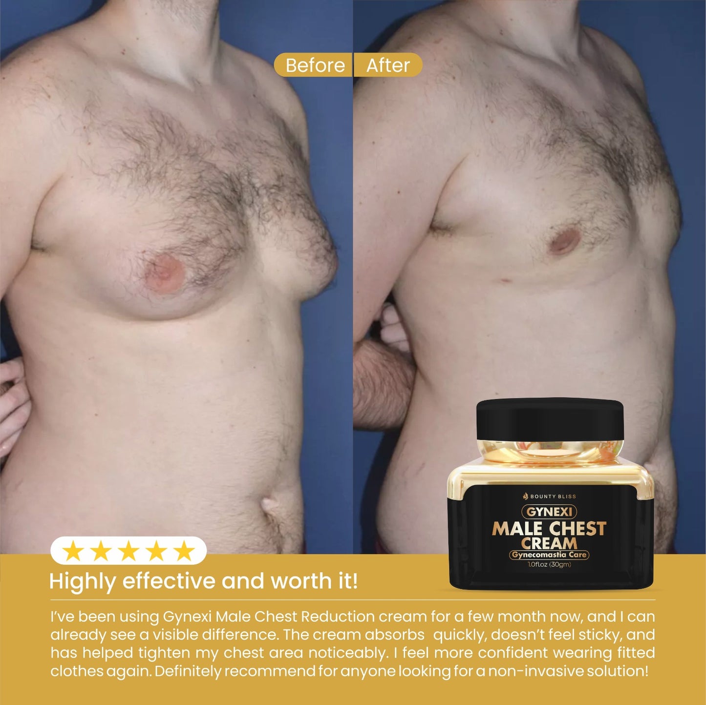 Bounty Bliss Gynecomastia Gynexi Male Chest Reduction Cream