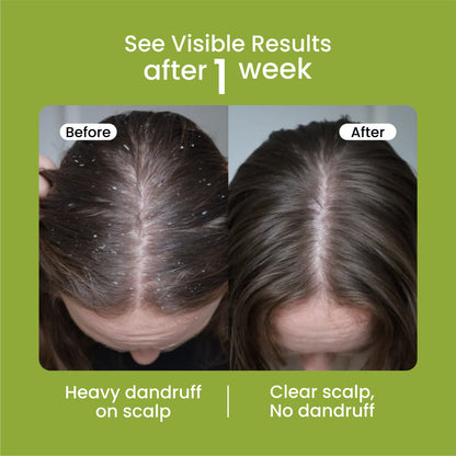 Mielle Natural Rosemary Essential Oil For Hair Growth & Strengthening Oil 59 ML