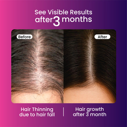 Bounty Bliss Biotin Advance Hair Growth Tablets