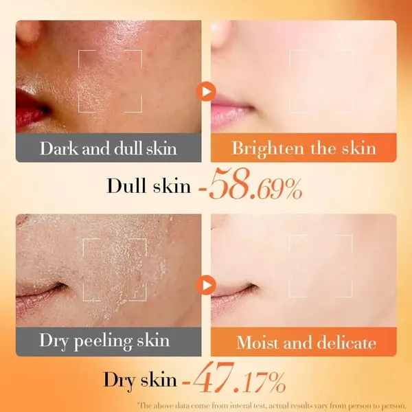 Bounty Bliss Bioaqua Vs + B5 Moisturizing Cream | Deep Hydration & Skin Repair | Vitamin B5 Enriched Face Cream For Soft, Smooth & Glowing Skin | Suitable For All Skin Types — photo 3